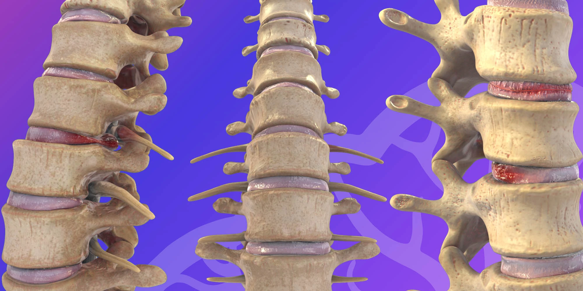 Back Spinal injuries image